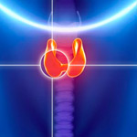 Boci Multinodular - malalties de la tiroide